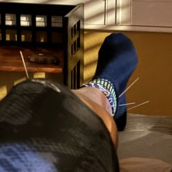 Challenor Acupuncture - Leg