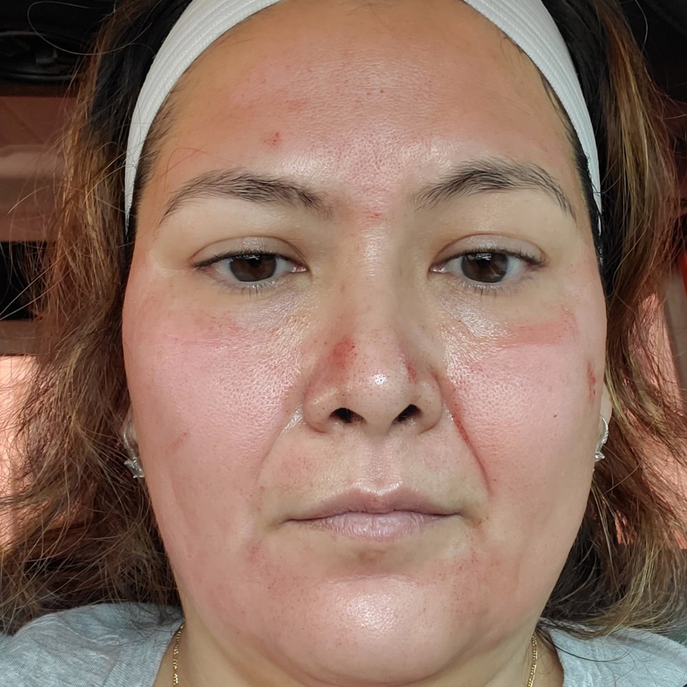 Mia Bella Esthetics - Day1 - Medical Spas Near Me - Houston, Texas Mia Bella Esthetics - Day1 - Medical Spas Near Me - Houston, Texas