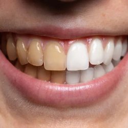 Kevin Bass DMD Cosmetic and Family Dentistry