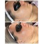 Photo of Enhancing Esthetics
