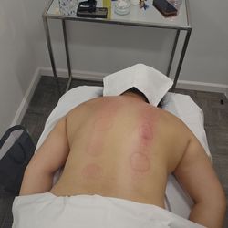 Deep tissue and combination with cupping therapy