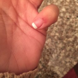 What they did to my nail. It hurts very bad and I paid 40$ for this