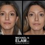 Michael V Elam, MD