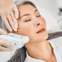 Youthful Spirit Aesthetics - Laser Treatment