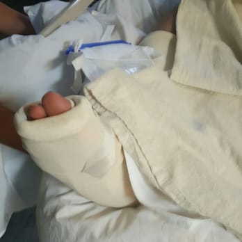Marshall - Sad foot presurgery, Marshall taking good care though! - Medical Centers Near Me - Placerville, California