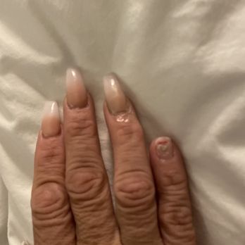 Cali Nails & Spa - Tired of glueing these nasty nails down and I find a fungus on my pinky. Be carful where you go. never again - Nail Salons Near Me - Corona, California Cali Nails & Spa - Tired of glueing these nasty nails down and I find a fungus on my pinky. Be carful where you go. never again - Nail Salons Near Me - Corona, California