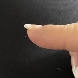 Every nail is lumpy like this.