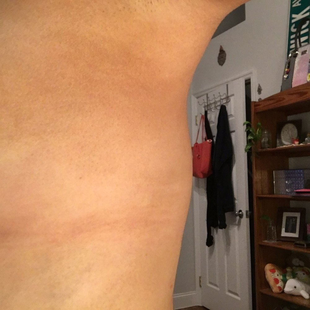 Bronze Boutique & Spa - Uneven lines - Day Spas Near Me - New York, New York Bronze Boutique & Spa - Uneven lines - Day Spas Near Me - New York, New York
