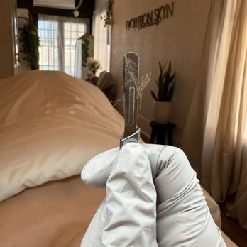 Evolution Skyn Aesthetics - Dermaplane - Skin Care Near Me - Riverside, California Evolution Skyn Aesthetics - Dermaplane - Skin Care Near Me - Riverside, California