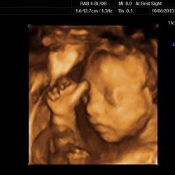 At First Sight 3D/4D Imaging and Boutique