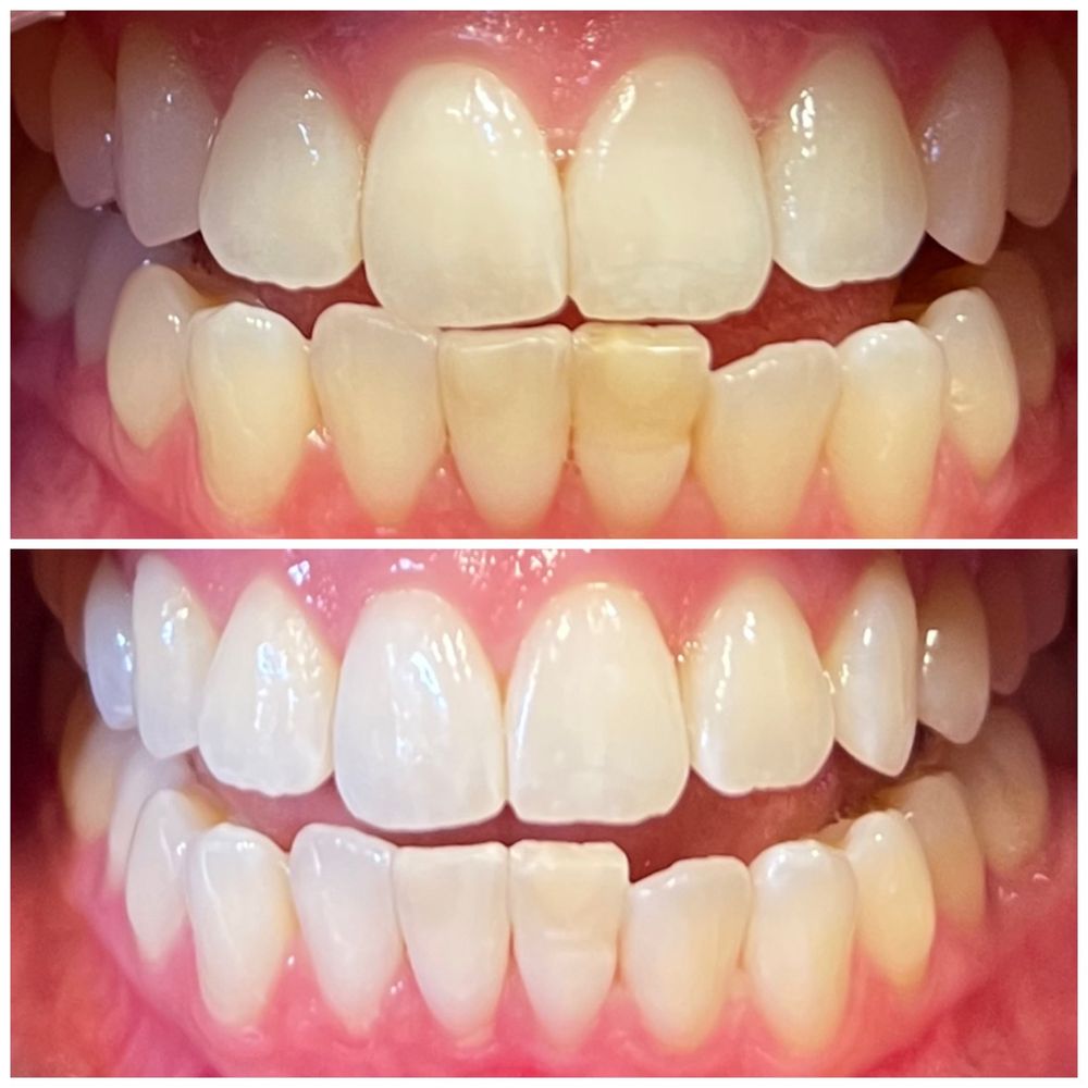 Before and after Before and after