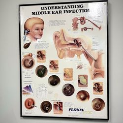 Siegel, Bosworth and Sorensen Division - Understanding your ear infections.