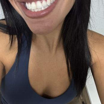 Moe's Teeth Whitening - Teeth Whitening Near Me - El Cajon, California Moe's Teeth Whitening - Teeth Whitening Near Me - El Cajon, California