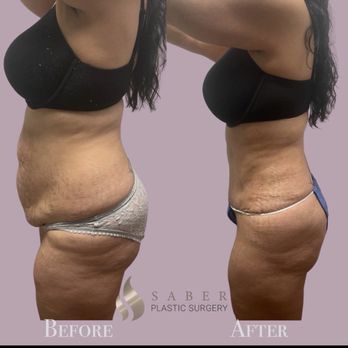 Saber Plastic Surgery - Plastic Surgeons Near Me - Encino, California Saber Plastic Surgery - Plastic Surgeons Near Me - Encino, California