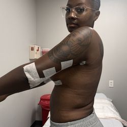 Mia Aesthetics - Post-op day 1
