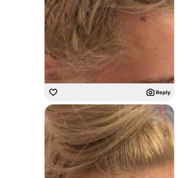 Rose Karapetian - Studio Four - Burns from bleach on skin (dm on insta) - Hair Extensions Near Me - Glendale, California