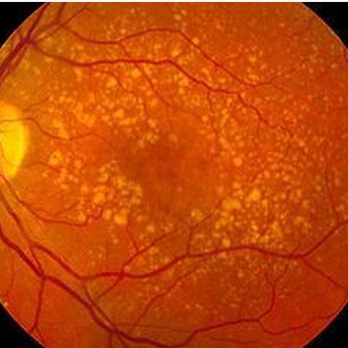 Grin Eye Care - Grin Eye Care | Olathe, KS - Optometrists Near Me - Olathe, Kansas Grin Eye Care - Grin Eye Care | Olathe, KS - Optometrists Near Me - Olathe, Kansas