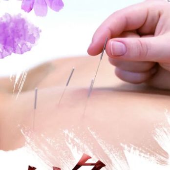 Lucy - acupuncture - Massage Therapy Near Me - London, XGL