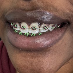 Hodson & Meister - Cool braces colors