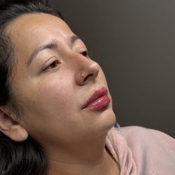 Allure Aesthetics RN