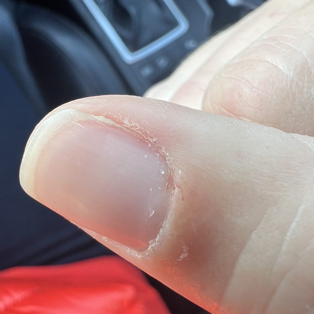 Sparkle Nails - Right thumb after plain manicure zoomed in. - Nail Salons Near Me - Austin, Texas