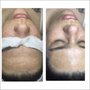 Bleu Spa and Beauty Studio