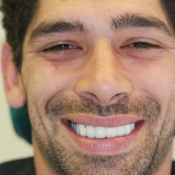 Dental Art Concepts - Our patient, Richard, smiles brightly.