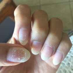 Tip and Toe Nails - This is what my two nails looked like after I paid and left, 5 seconds of scraping them myself with my hands.