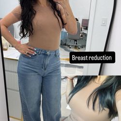 Alluring Plastic Surgery