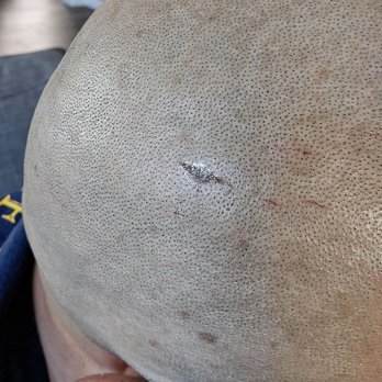 Generational Barbering - Stypic in the wound to stop the bleeding - Barbers Near Me - Murrieta, California Generational Barbering - Stypic in the wound to stop the bleeding - Barbers Near Me - Murrieta, California