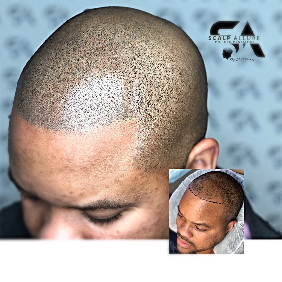 Scalp Allure Logo