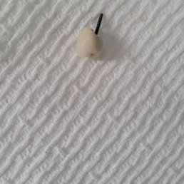 Here's the latest tooth from Now dental. I eat like a bird so, no it wasn't from eating and I don't chew gum. Here's the latest tooth from Now dental. I eat like a bird so, no it wasn't from eating and I don't chew gum.