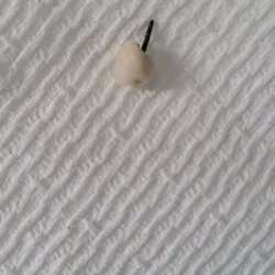 Now Dental - Here's the latest tooth from Now dental. I eat like a bird so, no it wasn't from eating and I don't chew gum.