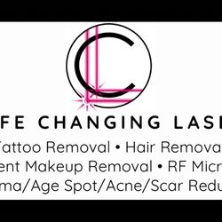 Life Changing Laser - Tattoo removal, hair removal, permanent makeup removal, Radio frequency Microneedling, Melasma, age spot, acne and surgical scar removal!