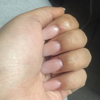 Sophie's Nail Spa - Nicked me with the nail drill tool multiple times - Nail Salons Near Me - San Anselmo, California Sophie's Nail Spa - Nicked me with the nail drill tool multiple times - Nail Salons Near Me - San Anselmo, California