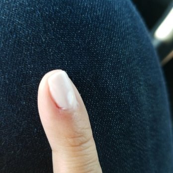 Nails 4 U & Spa - Blood on pinky finger - Nail Salons Near Me - Fullerton, California