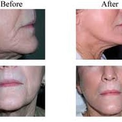 Sun Care Spray Tan & Skin Care Salon