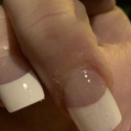 Picture of the horrible job done at Diana's nails