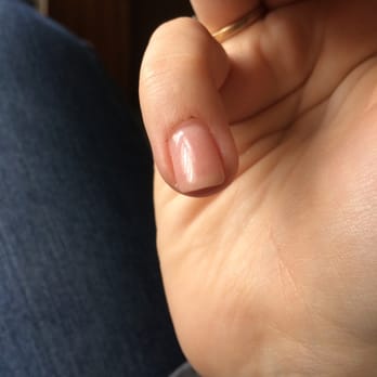Nail Works - Five days later - Nail Salons Near Me - Latham, New York