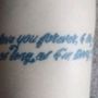 Photo of Louisville Tattoo Removal