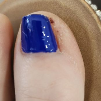 Luxury Nails & Spa - These were done on 5/20/23, & today is 5/21. This looks awful!!! - Nail Salons Near Me - Naples, Florida Luxury Nails & Spa - These were done on 5/20/23, & today is 5/21. This looks awful!!! - Nail Salons Near Me - Naples, Florida