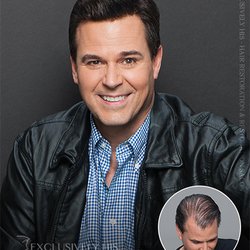 Hair Specialists - Lincoln - Hair Replacment
