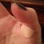 Photo of Hand & UpperEx Center