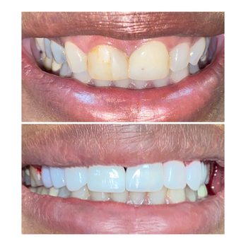 Yorktown Dental Spa - Venners - General Dentistry Near Me - Houston, Texas Yorktown Dental Spa - Venners - General Dentistry Near Me - Houston, Texas