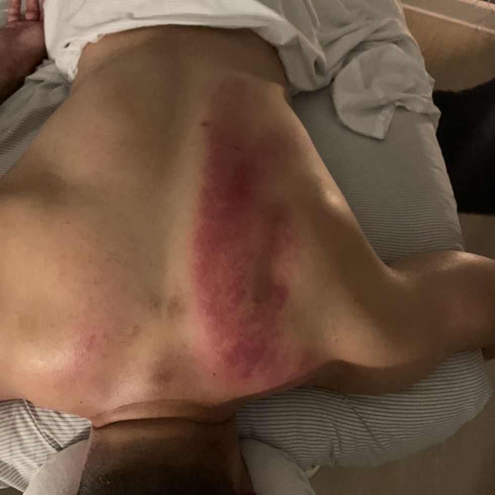 Knotted Up - Massage Therapy Near Me - Rancho Cucamonga, California Knotted Up - Massage Therapy Near Me - Rancho Cucamonga, California