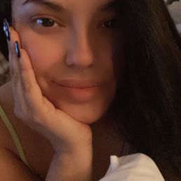 Love my skin! Love my skin!