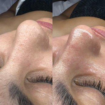 Caroline Stein Beauty - Skin Care Near Me - Del Mar, California