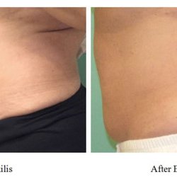 Skin & Allergy Center