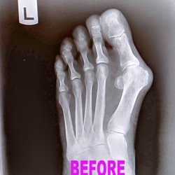 Libertyville Podiatry - Left foot Before