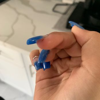 Champagne Nail Spa - This cut wouldn't stop bleeding - Nail Salons Near Me - Hialeah, Florida